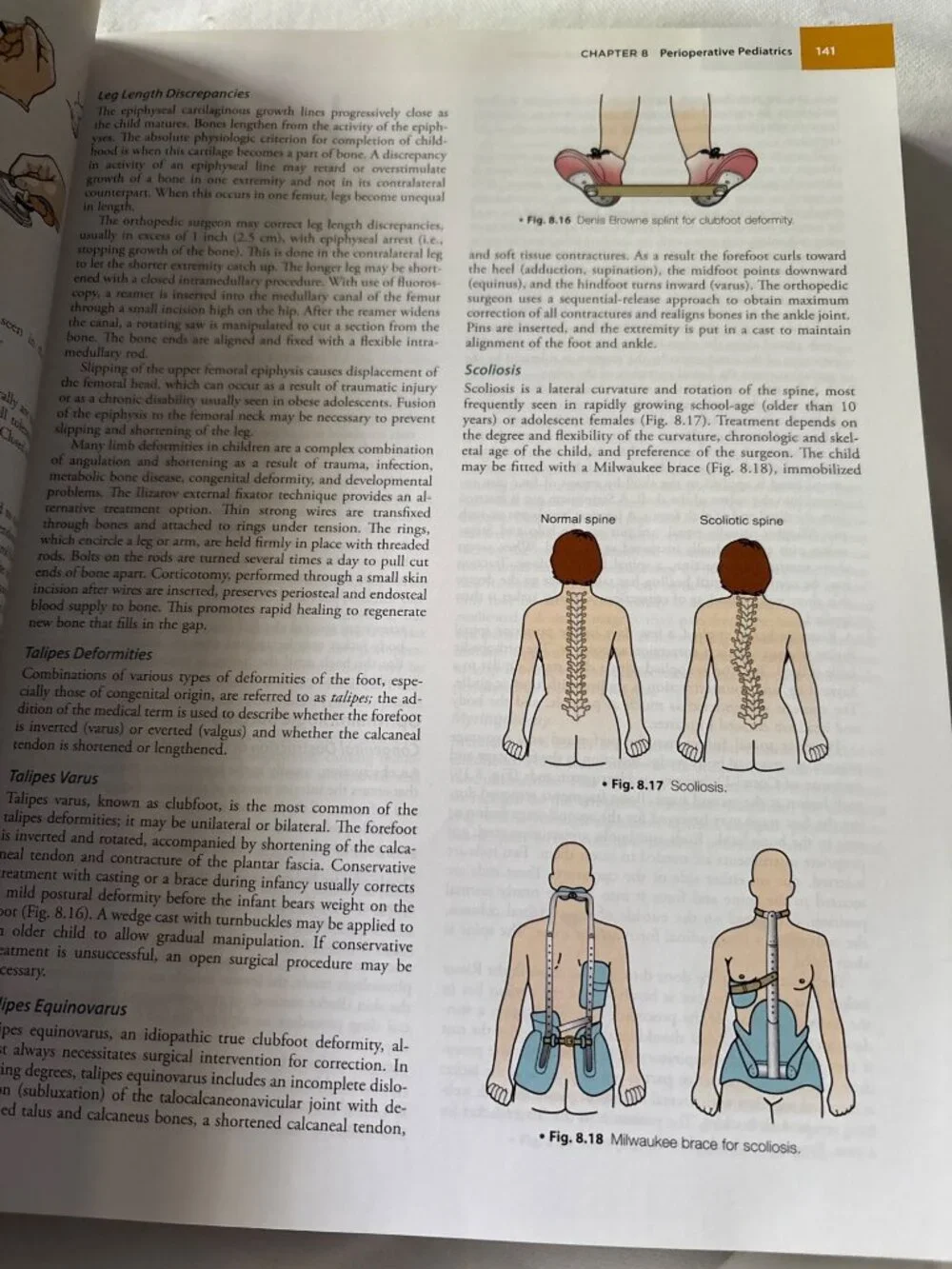 Berry & Kohns Operating Room Technique 14th Edition By Phillips & Hornacky